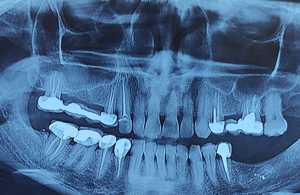 مبینا ایرانشاهی | آکادمی امروز